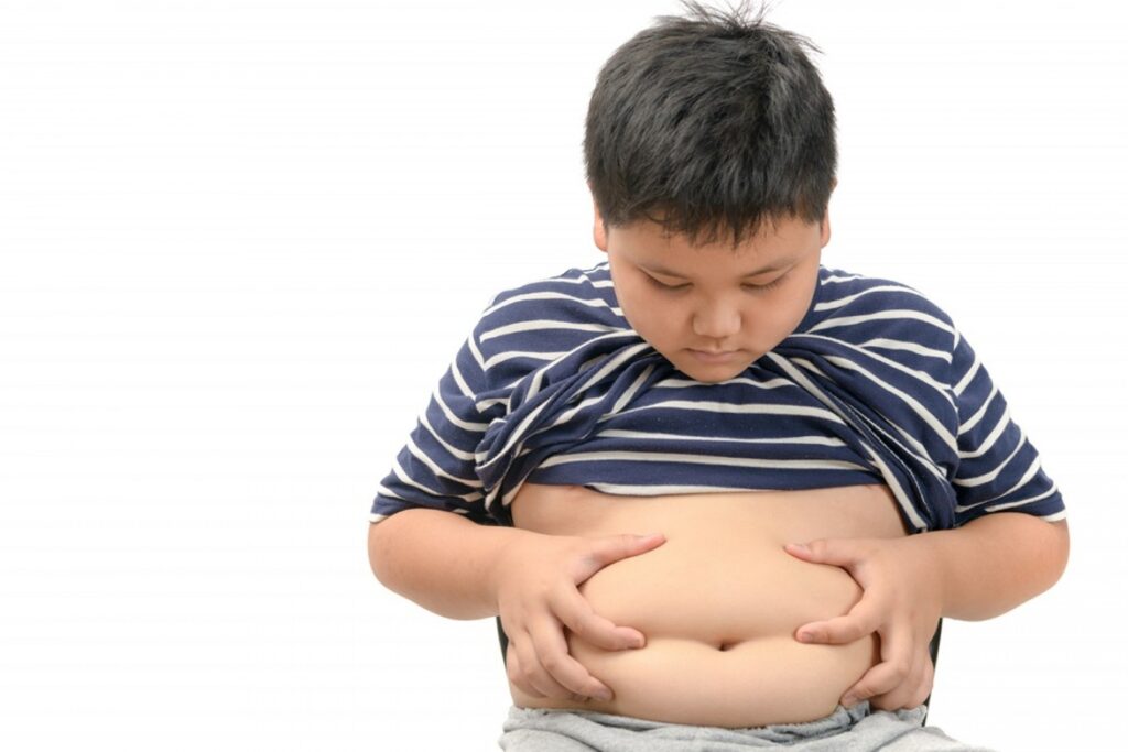 Managing Childhood Obesity: Expert Tips from Pediatricians for a Healthier Future